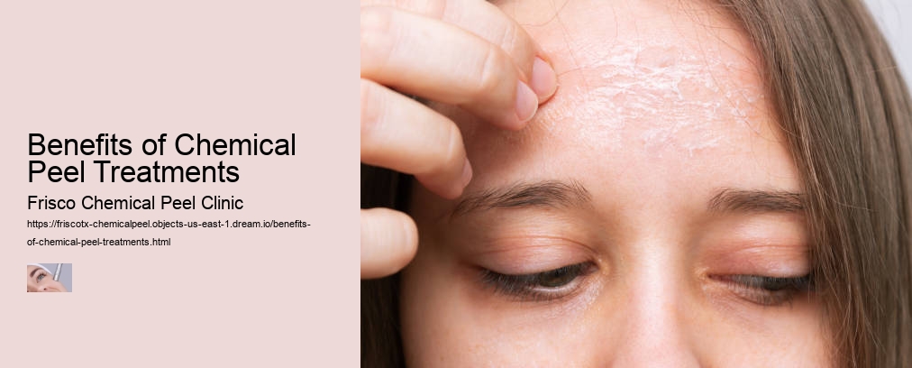 Benefits of Chemical Peel Treatments