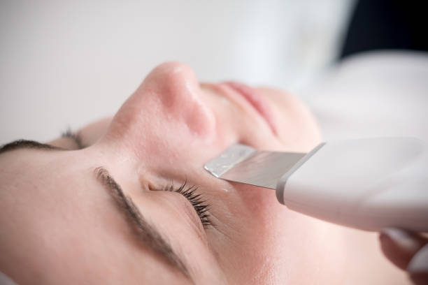 Uncover a Brighter Complexion: Try Chemical Peel Treatments near Frisco