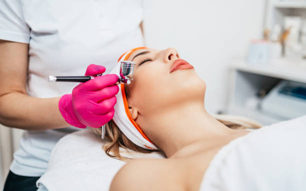 What types of chemical peels are available at spas near Frisco?