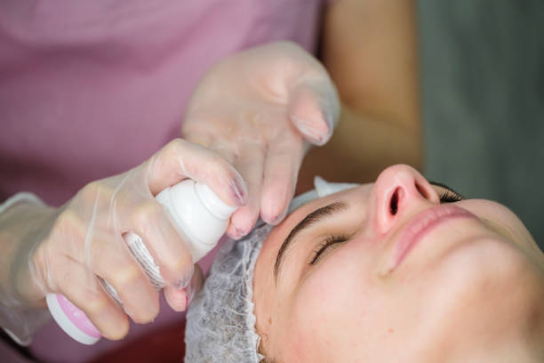 What are the benefits of getting a chemical peel near Frisco?