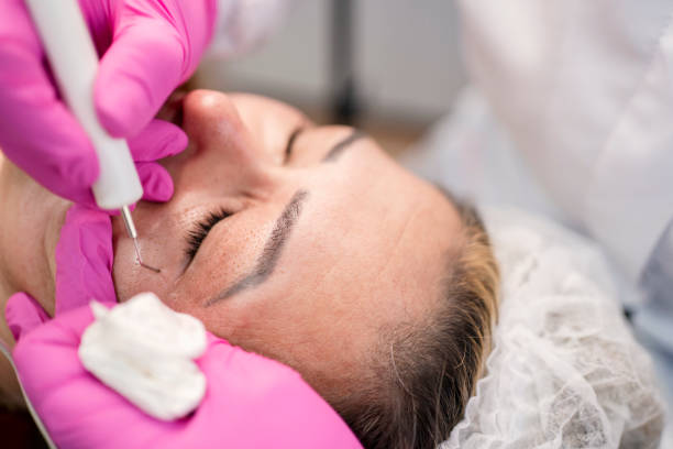 Different types of chemical peels available near Frisco 