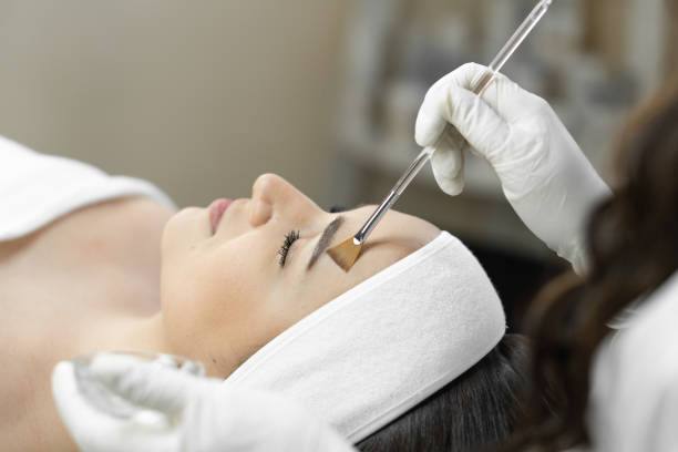 How to Achieve Flawless Skin: Chemical Peel Treatments near Frisco