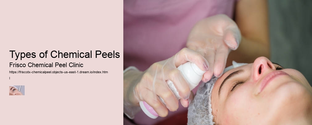 Types of Chemical Peels
