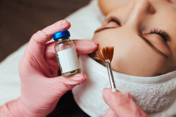 What results can you achieve with regular chemical peel treatments in the Frisco area?